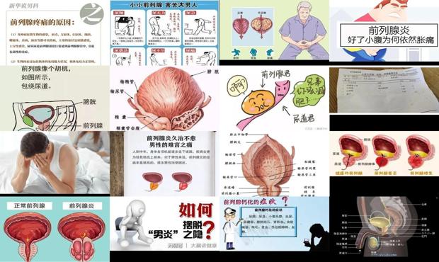 汕头前列腺炎症是什么原因造成的