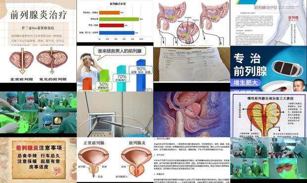汕头激光怎么治疗前列腺炎