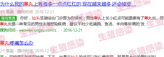 汕头辜丸炎症