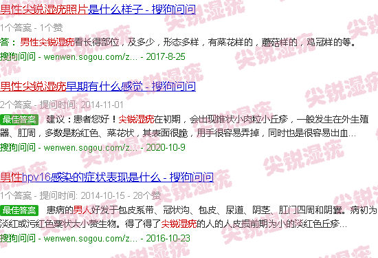 汕头男人尖锐湿疣照片