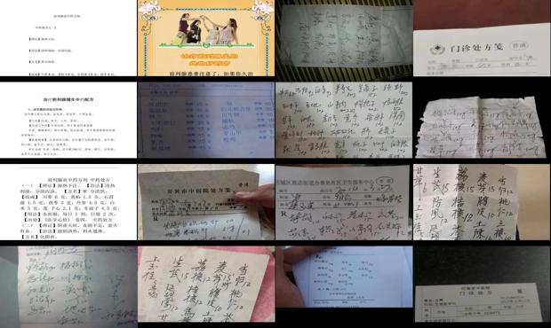 汕头治疗前列腺的中药处方