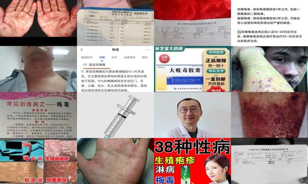 汕头治疗梅毒哪里好