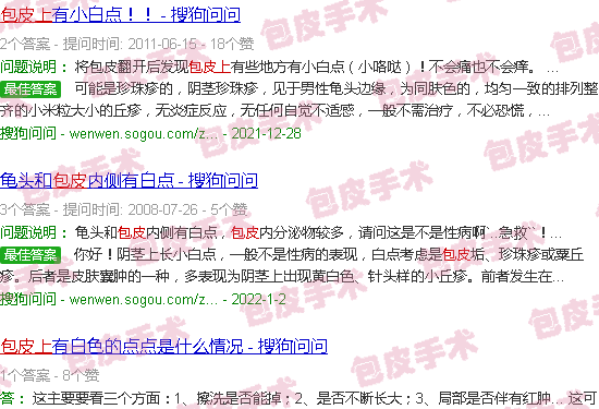 汕头包皮上长白点