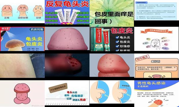 汕头包皮泛红