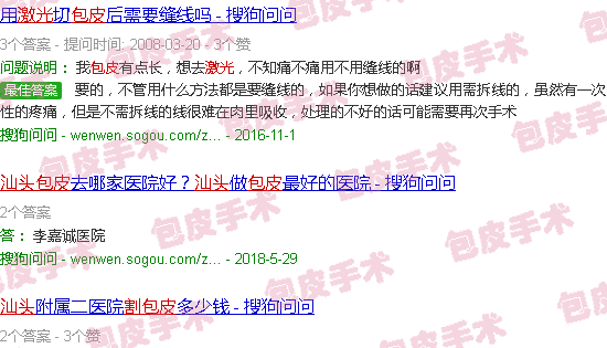 汕头激光割包皮