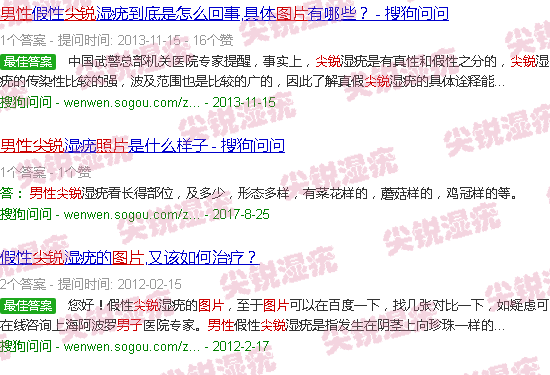 汕头男性尖锐图片