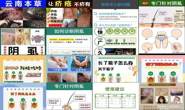 汕头阴虱怎么*去除*简单的方法