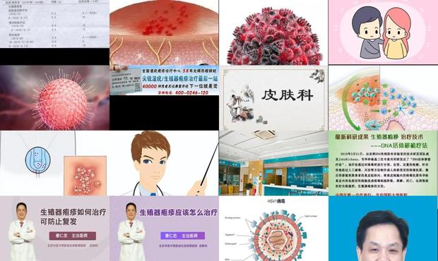 汕头治疗生殖器疱疹*好的医院