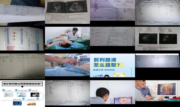 汕头怎么检查前列腺有没有问题