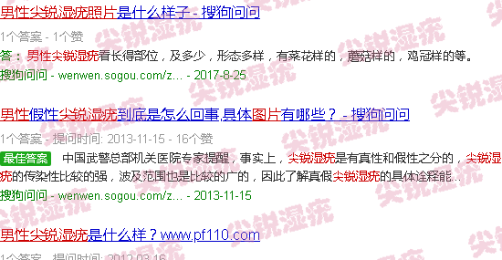 汕头男性尖锐湿疣图片大*
