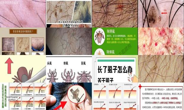 汕头男人长阴虱是什么原因