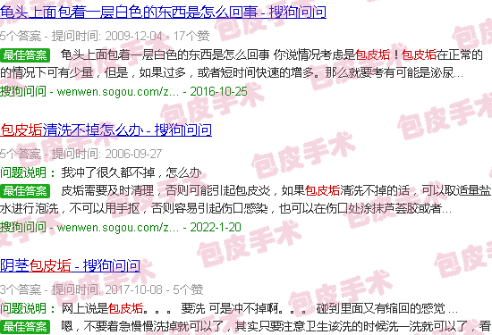 汕头包皮垢