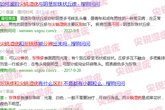 汕头珍珠疹和尖锐湿疣区别