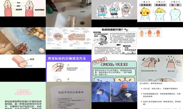 汕头包皮疼吗