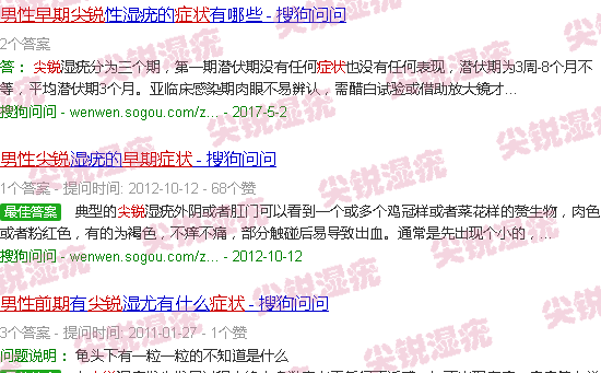 汕头尖锐男性早期症状