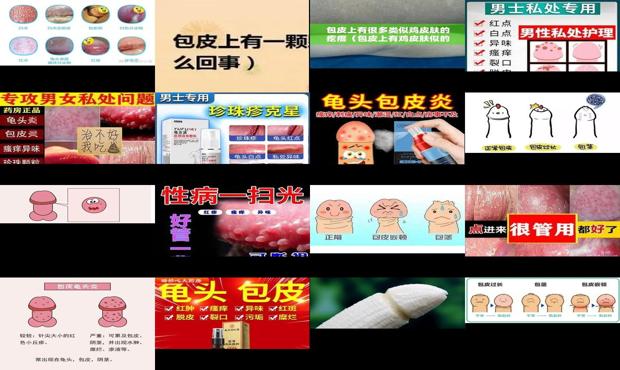 汕头包皮有白点
