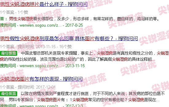 汕头男性尖锐湿疣高清图照片