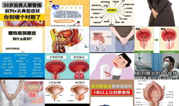 汕头得了前列腺炎症状有哪些