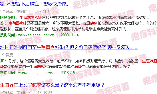汕头生殖器官疱疹能不能好