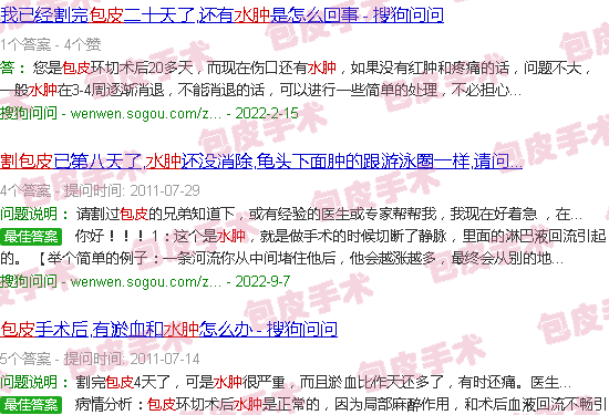 汕头割包皮水肿