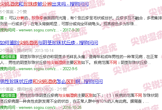汕头珍珠疹和尖锐湿疣区别图