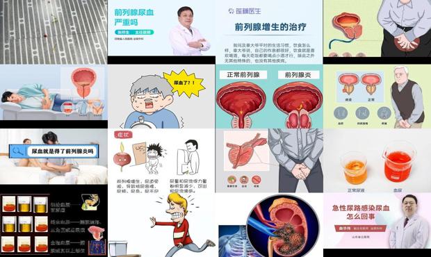 汕头前列腺尿血要卧床吗