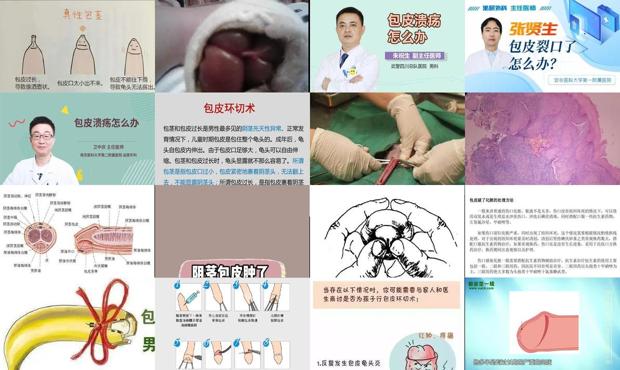 汕头包皮破了怎么办