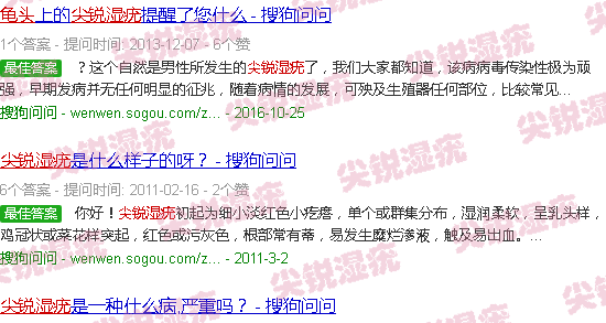 汕头龟头尖锐湿疣