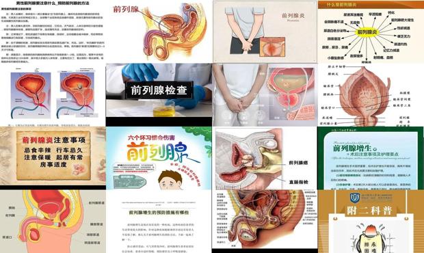 汕头前列腺需要注意些什么
