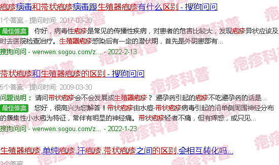 汕头生殖疱疹和带状疱疹的区别