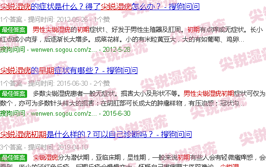 汕头男性尖锐湿疣初期高清图