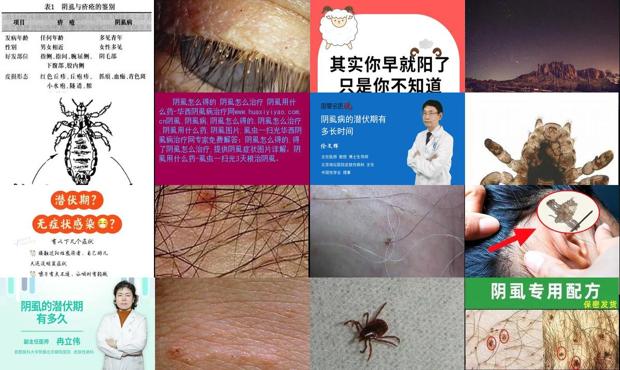 汕头阴虱的潜伏期是多久