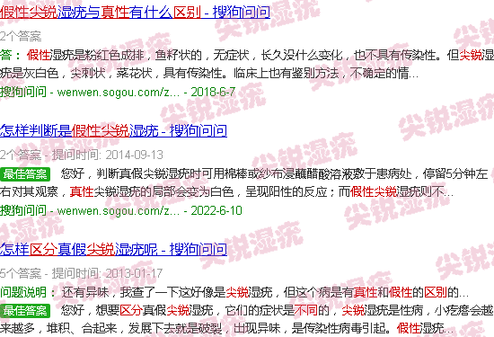汕头假性尖锐和真性区别图