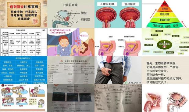 汕头慢性前列腺炎和早泄