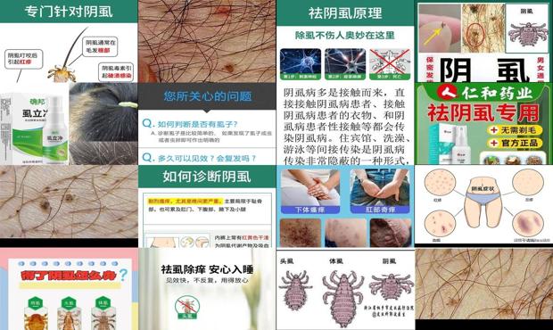汕头阴虱的*佳治疗方法