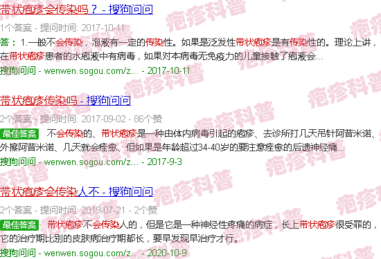 汕头带状疱疹传染吗