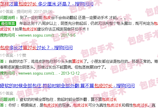 汕头包皮如何算过长