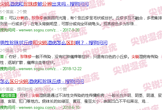 汕头珍珠疹和尖锐的区别图