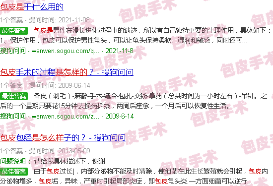 汕头包皮是怎样的