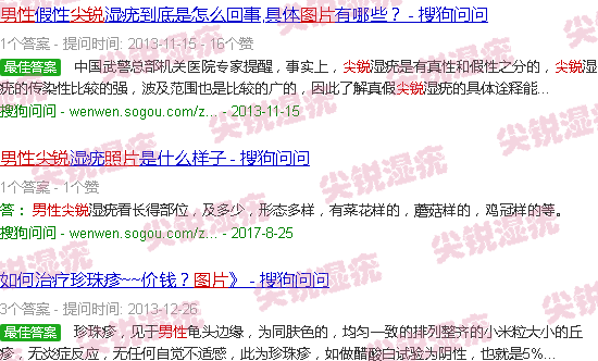 汕头男性尖锐初期图片