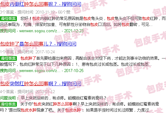 汕头包皮肿了怎么回事