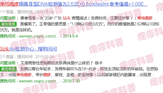 汕头单纯性疱疹