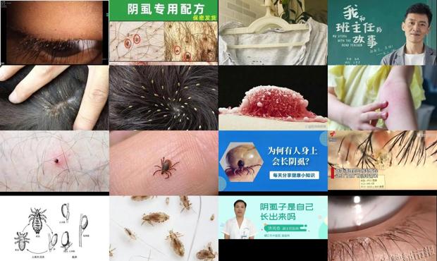 汕头为什么会长阴虱子的原因
