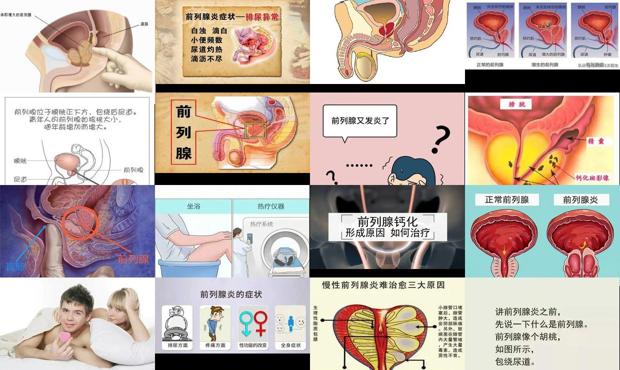 汕头男人做爱多了会影响前列腺炎症吗