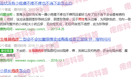 汕头男性生殖疱疹图片