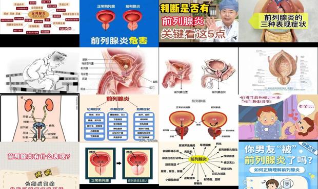 汕头前列腺炎有什么危害吗