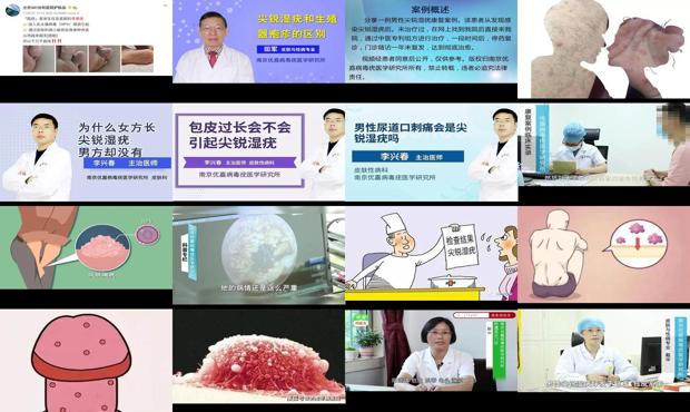 汕头男性生殖器尖锐