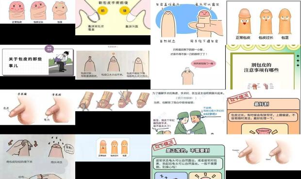 汕头割包皮对人体有害吗
