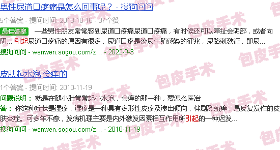汕头包皮肿是什么引起