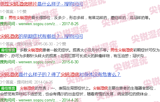 汕头尖锐湿尤图男人图片